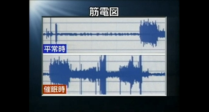 東京電機大学で平常時と催眠時の違いを計測する7