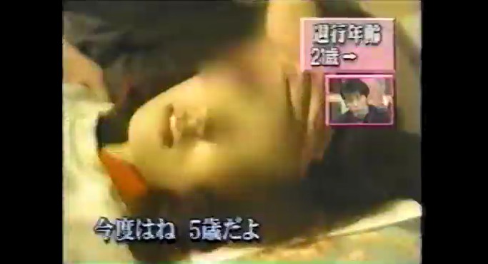 過食症で悩む女性が退行催眠術をかけられる3